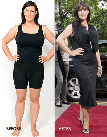 Anna-BeforeAfter